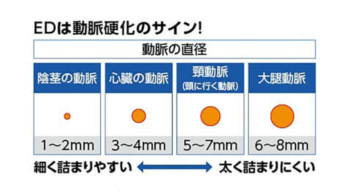 EDは動脈硬化のサイン！