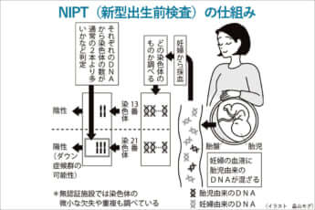 NIPT（新型出生前検査）の仕組み